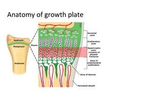 Growth Plate Chart.pdf CME_FRACTURE.pptx