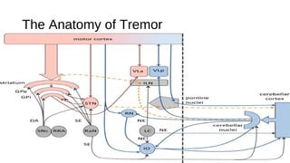 The Anatomy of Tremor
 