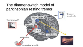 The dimmer-switch model of
parkinsonian resting tremor
 
