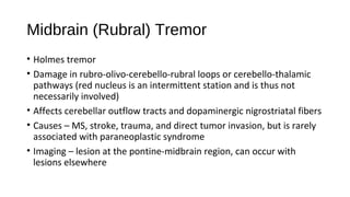 Midbrain (Rubral) Tremor
• Holmes tremor
• Damage in rubro-olivo-cerebello-rubral loops or cerebello-thalamic
pathways (red nucleus is an intermittent station and is thus not
necessarily involved)
• Affects cerebellar outflow tracts and dopaminergic nigrostriatal fibers
• Causes – MS, stroke, trauma, and direct tumor invasion, but is rarely
associated with paraneoplastic syndrome
• Imaging – lesion at the pontine-midbrain region, can occur with
lesions elsewhere
 