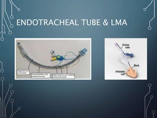ENDOTRACHEAL TUBE & LMA
 