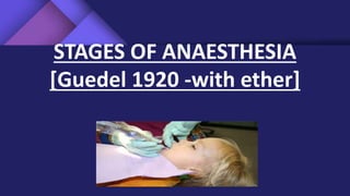 STAGES OF ANAESTHESIA
[Guedel 1920 -with ether]
 