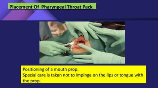 Positioning of a mouth prop.
Special care is taken not to impinge on the lips or tongue with
the prop.
Placement Of Pharyngeal Throat Pack
 
