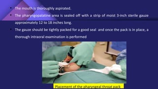 Placement of the pharyngeal throat pack
• The mouth is thoroughly aspirated.
• The pharyngopalatine area is sealed off with a strip of moist 3-inch sterile gauze
approximately 12 to 18 inches long.
• The gauze should be tightly packed for a good seal and once the pack is in place, a
thorough intraoral examination is performed
 