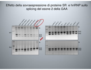 Effetto della sovraespressione di proteine SR e hnRNP sullo 
WT 
Mut 
N 
SV3 
SV2 
N 
SV3 
SV2 
- 
splicing del esone 2 della GAA 
N 
SV3 
SV2 
SV3 
SV2 
- 
N 
 
