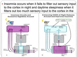  Insomnia occurs when it fails to filter out sensory input
to the cortex in night and daytime sleepiness when it
filters out too much sensory input to the cortex in the
daytime.
 