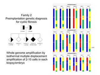 Family 2 
Preimplantation genetic diagnosis 
for cystic fibrosis 
Whole genome amplification by 
isothermal multiple displacement 
amplification of 2-10 cells in each 
biopsy/embryo 
 