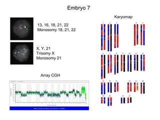 Embryo 7 
13, 16, 18, 21, 22 
Monosomy 18, 21, 22 
X, Y, 21 
Trisomy X 
Monosomy 21 
Array CGH 
Karyomap 
 