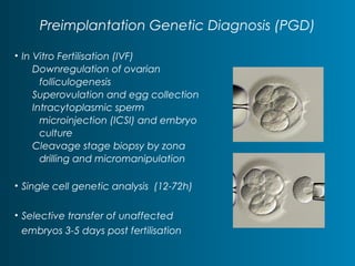 Preimplantation Genetic Diagnosis (PGD) 
• In Vitro Fertilisation (IVF) 
Downregulation of ovarian 
folliculogenesis 
Superovulation and egg collection 
Intracytoplasmic sperm 
microinjection (ICSI) and embryo 
culture 
Cleavage stage biopsy by zona 
drilling and micromanipulation 
• Single cell genetic analysis (12-72h) 
• Selective transfer of unaffected 
embryos 3-5 days post fertilisation 
 