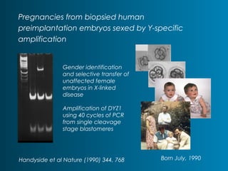 Pregnancies from biopsied human 
preimplantation embryos sexed by Y-specific 
amplification 
Handyside et al Nature (1990) 344, 768 
Born July, 1990 
Gender identification 
and selective transfer of 
unaffected female 
embryos in X-linked 
disease 
Amplification of DYZ1 
using 40 cycles of PCR 
from single cleavage 
stage blastomeres 
 