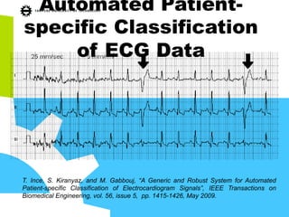 Automated Patient-
specific Classification
of ECG Data
T. Ince, S. Kiranyaz, and M. Gabbouj, “A Generic and Robust System for Automated
Patient-specific Classification of Electrocardiogram Signals”, IEEE Transactions on
Biomedical Engineering, vol. 56, issue 5, pp. 1415-1426, May 2009.
 