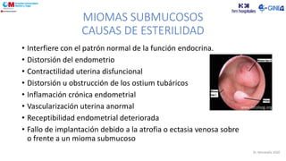MIOMAS SUBMUCOSOS
CAUSAS DE ESTERILIDAD
• Interfiere con el patrón normal de la función endocrina.
• Distorsión del endometrio
• Contractilidad uterina disfuncional
• Distorsión u obstrucción de los ostium tubáricos
• Inflamación crónica endometrial
• Vascularización uterina anormal
• Receptibilidad endometrial deteriorada
• Fallo de implantación debido a la atrofia o ectasia venosa sobre
o frente a un mioma submucoso
Dr. Moratalla 2020
 