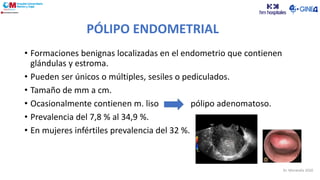 PÓLIPO ENDOMETRIAL
• Formaciones benignas localizadas en el endometrio que contienen
glándulas y estroma.
• Pueden ser únicos o múltiples, sesiles o pediculados.
• Tamaño de mm a cm.
• Ocasionalmente contienen m. liso pólipo adenomatoso.
• Prevalencia del 7,8 % al 34,9 %.
• En mujeres infértiles prevalencia del 32 %.
Dr. Moratalla 2020
 