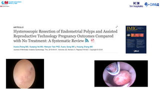 Dado que más del 70% de los pólipos persisten hasta 1 año con
manejo expectante y el tiempo es esencial en los pacientes con
infertilidad se recomienda restaurar la anatomía normal antes de los
tratamientos de fertilidad
 