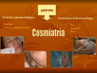 Cosmiatría gabinete Práctica dermatológica Asistencia   al dermatólogo Peelings  Lesiones pigmentarias Pre  Durante  Post 