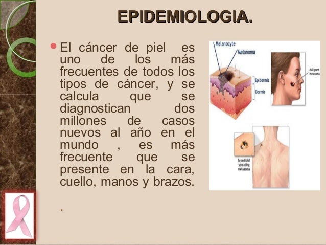 CÁNCER DE LA PIEL: EPIDEMIOLOGIA