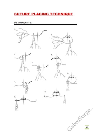 15
SUTURE PLACING TECHNIQUE
G
abroSurge..
 