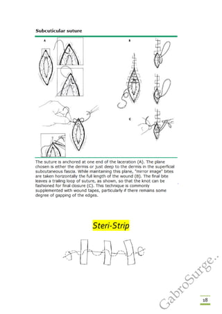 18
Steri-Strip
G
abroSurge..
 