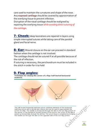 25
care used to maintain the curvatures and shape of the nose.
Any exposed cartilage should be covered by approximation of
the overlying tissue to prevent infection.
Disruption of the nasal cartilage should be realigned by
repairing the overlying tissue while avoiding direct suturing of
the cartilage.
7- Cheek: deep lacerations are repaired in layers using
simple interrupted sutures while taking care of the parotid
gland and facial nerve.
8- Ear: Wound closure on the ear can proceed in standard
fashion when the cartilage is not involved.
The cartilage should not be sutured if at all possible because of
the risk of infection.
If suturing is necessary, the perichondrium must be included in
the stitch in order for it to hold
9- Flap angles:
G
abroSurge..
 