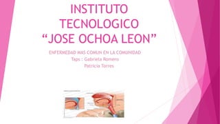 INSTITUTO
TECNOLOGICO
“JOSE OCHOA LEON”
ENFERMEDAD MAS COMUN EN LA COMUNIDAD
Taps : Gabriela Romero
Patricia Torres
 