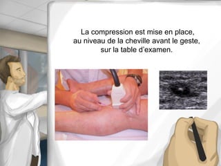 La compression est mise en place,
au niveau de la cheville avant le geste,
sur la table d’examen.
 