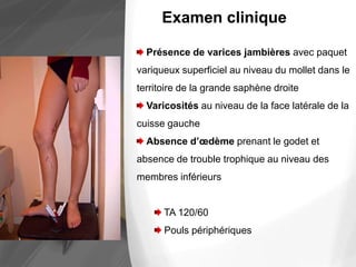 Présence de varices jambières avec paquet
variqueux superficiel au niveau du mollet dans le
territoire de la grande saphène droite
Varicosités au niveau de la face latérale de la
cuisse gauche
Absence d’œdème prenant le godet et
absence de trouble trophique au niveau des
membres inférieurs
TA 120/60
Pouls périphériques
Examen clinique
 