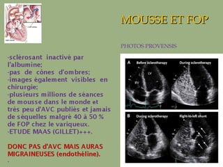 MOUSSE ET FOP PHOTOS PROVENSIS 