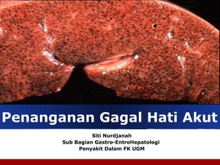 Company
LOGO
Penanganan Gagal Hati Akut
Siti Nurdjanah
Sub Bagian Gastro-EntroHepatologi
Penyakit Dalam FK UGM
 