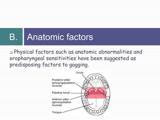 gag reflex nerve gag reflex nerve