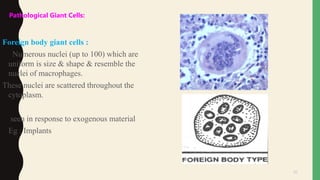 20
Pathological Giant Cells:
Foreign body giant cells :
Numerous nuclei (up to 100) which are
uniform is size & shape & resemble the
nuclei of macrophages.
These nuclei are scattered throughout the
cytoplasm.
• seen in response to exogenous material
• Eg : Implants
 