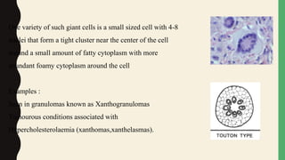One variety of such giant cells is a small sized cell with 4-8
nuclei that form a tight cluster near the center of the cell
around a small amount of fatty cytoplasm with more
abundant foamy cytoplasm around the cell
Examples :
Seen in granulomas known as Xanthogranulomas
Tumourous conditions associated with
Hypercholesterolaemia (xanthomas,xanthelasmas).
 
