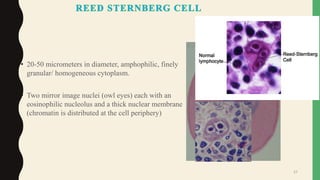 • 20-50 micrometers in diameter, amphophilic, finely
granular/ homogeneous cytoplasm.
• Two mirror image nuclei (owl eyes) each with an
eosinophilic nucleolus and a thick nuclear membrane
(chromatin is distributed at the cell periphery)
27
 
