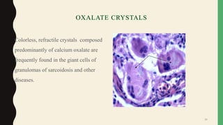 • Colorless, refractile crystals composed
predominantly of calcium oxalate are
frequently found in the giant cells of
granulomas of sarcoidosis and other
diseases.
34
 