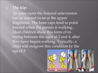 Gait | PPT
