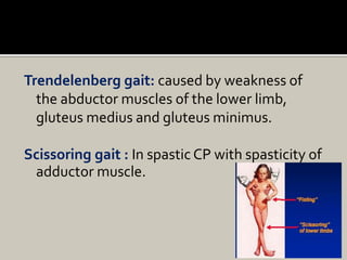 Trendelenberg gait: caused by weakness of
the abductor muscles of the lower limb,
gluteus medius and gluteus minimus.
Scissoring gait : In spastic CP with spasticity of
adductor muscle.
 