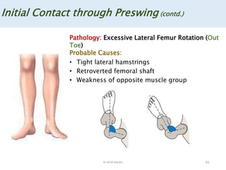 Dr M M Abedin 41
Initial Contact through Preswing (contd.)
Pathology: Excessive Lateral Femur Rotation (Out
Toe)
Probable Causes:
• Tight lateral hamstrings
• Retroverted femoral shaft
• Weakness of opposite muscle group
 