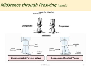 Dr M M Abedin 50
Midstance through Preswing (contd.)
 