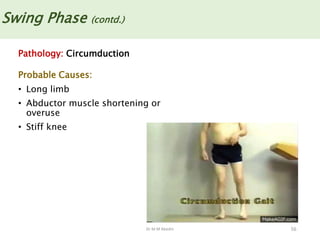 Dr M M Abedin 56
Swing Phase (contd.)
Pathology: Circumduction
Probable Causes:
• Long limb
• Abductor muscle shortening or
overuse
• Stiff knee
 