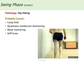 Dr M M Abedin 57
Swing Phase (contd.)
Pathology: Hip Hiking
Probable Causes:
• Long limb
• Quadratus lumborum shortening
• Weak hamstring
• Stiff knee
 
