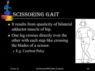 Scissoring gait
    It results from spasticity of bilateral
     adductor muscle of hip.
    One leg crosses directly over the
     other with each step like crossing
     the blades of a scissor.
         E.g. Cerebral Palsy



    22-Jun-12          P.R.Khuman(MPT,Ortho & Sports)   82
 
