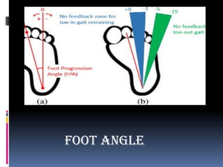 Foot angle
 
