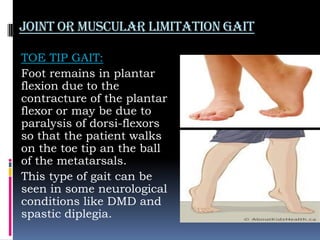 Joint or muscular limitation gait
TOE TIP GAIT:
Foot remains in plantar
flexion due to the
contracture of the plantar
flexor or may be due to
paralysis of dorsi-flexors
so that the patient walks
on the toe tip an the ball
of the metatarsals.
This type of gait can be
seen in some neurological
conditions like DMD and
spastic diplegia.
 