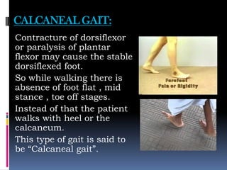CALCANEAL GAIT:
Contracture of dorsiflexor
or paralysis of plantar
flexor may cause the stable
dorsiflexed foot.
So while walking there is
absence of foot flat , mid
stance , toe off stages.
Instead of that the patient
walks with heel or the
calcaneum.
This type of gait is said to
be “Calcaneal gait”.
 