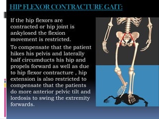 HIP FLEXOR CONTRACTURE GAIT:
If the hip flexors are
contracted or hip joint is
ankylosed the flexion
movement is restricted.
To compensate that the patient
hikes his pelvis and laterally
half circumducts his hip and
propels forward as well as due
to hip flexor contracture , hip
extension is also restricted to
compensate that the patients
do more anterior pelvic tilt and
lordosis to swing the extremity
forwards.
 