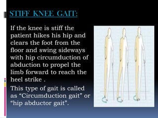 STIFF KNEE GAIT:
If the knee is stiff the
patient hikes his hip and
clears the foot from the
floor and swing sideways
with hip circumduction of
abduction to propel the
limb forward to reach the
heel strike .
This type of gait is called
as “Circumduction gait” or
“hip abductor gait”.
 