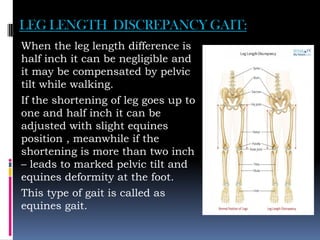 LEG LENGTH DISCREPANCY GAIT:
When the leg length difference is
half inch it can be negligible and
it may be compensated by pelvic
tilt while walking.
If the shortening of leg goes up to
one and half inch it can be
adjusted with slight equines
position , meanwhile if the
shortening is more than two inch
– leads to marked pelvic tilt and
equines deformity at the foot.
This type of gait is called as
equines gait.
 