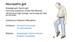 Neuropathic gait
Steppage gait, Equine gait
Foot drop (weakness of foot dorsiflexion)
Lift the knee high enough, not to drag the foot
on the floor
Unilateral or bilateral LMN palsies
Unilateral : Peroneal nerve palsy
L5 radiculopathy
Bilateral : Amyotrophic lateral sclerosis
Diabetic neuropathy
 