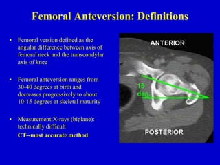 Femoral Anteversion: Definitions
• Femoral version defined as the
angular difference between axis of
femoral neck and the transcondylar
axis of knee
• Femoral anteversion ranges from
30-40 degrees at birth and
decreases progressively to about
10-15 degrees at skeletal maturity
• Measurement:X-rays (biplane):
technically difficult
CT--most accurate method
 