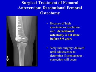 Surgical Treatment of Femoral
Anteversion: Derotational Femoral
Osteotomy
• Because of high
spontaneous resolution
rate...derotational
osteotomy is not done
before 8-9 years
• Very rare surgery: delayed
until adolescence to
determine if spontaneous
correction will occur
 