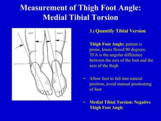 Measurement of Thigh Foot Angle:
Medial Tibial Torsion
3.) Quantify Tibial Version
Thigh Foot Angle: patient is
prone, knees flexed 90 degrees:
TFA is the angular difference
between the axis of the foot and the
axis of the thigh
• Allow foot to fall into natural
position, avoid manual positioning
of foot
• Medial Tibial Torsion: Negative
Thigh Foot Angle
 